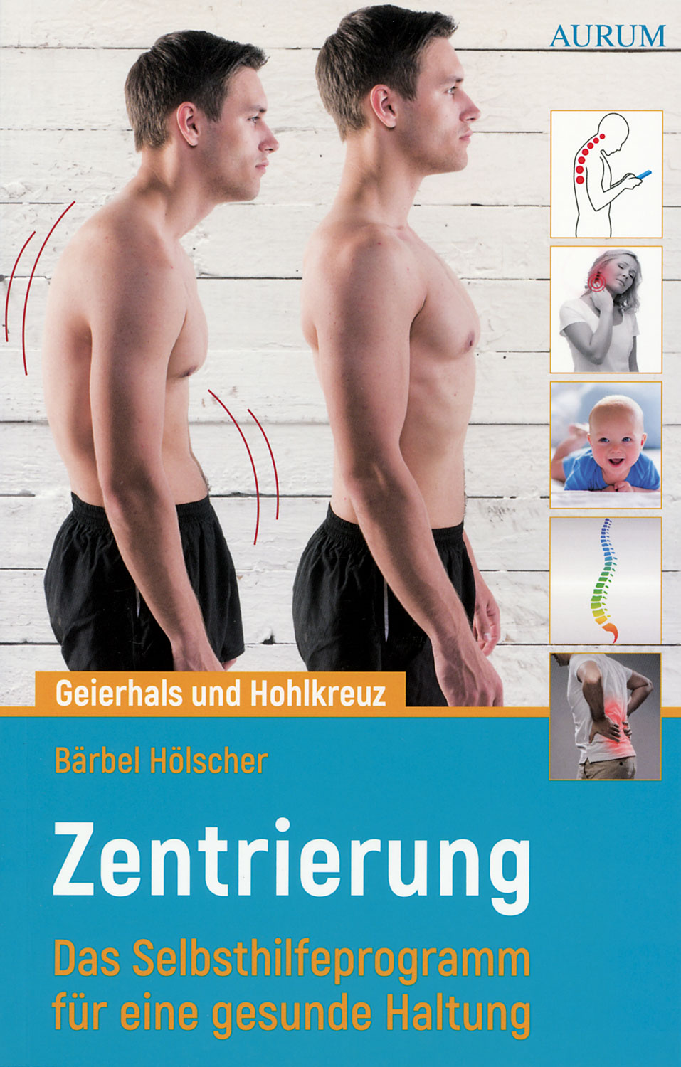 Geierhals und Hohlkreuz - Mngelartikel