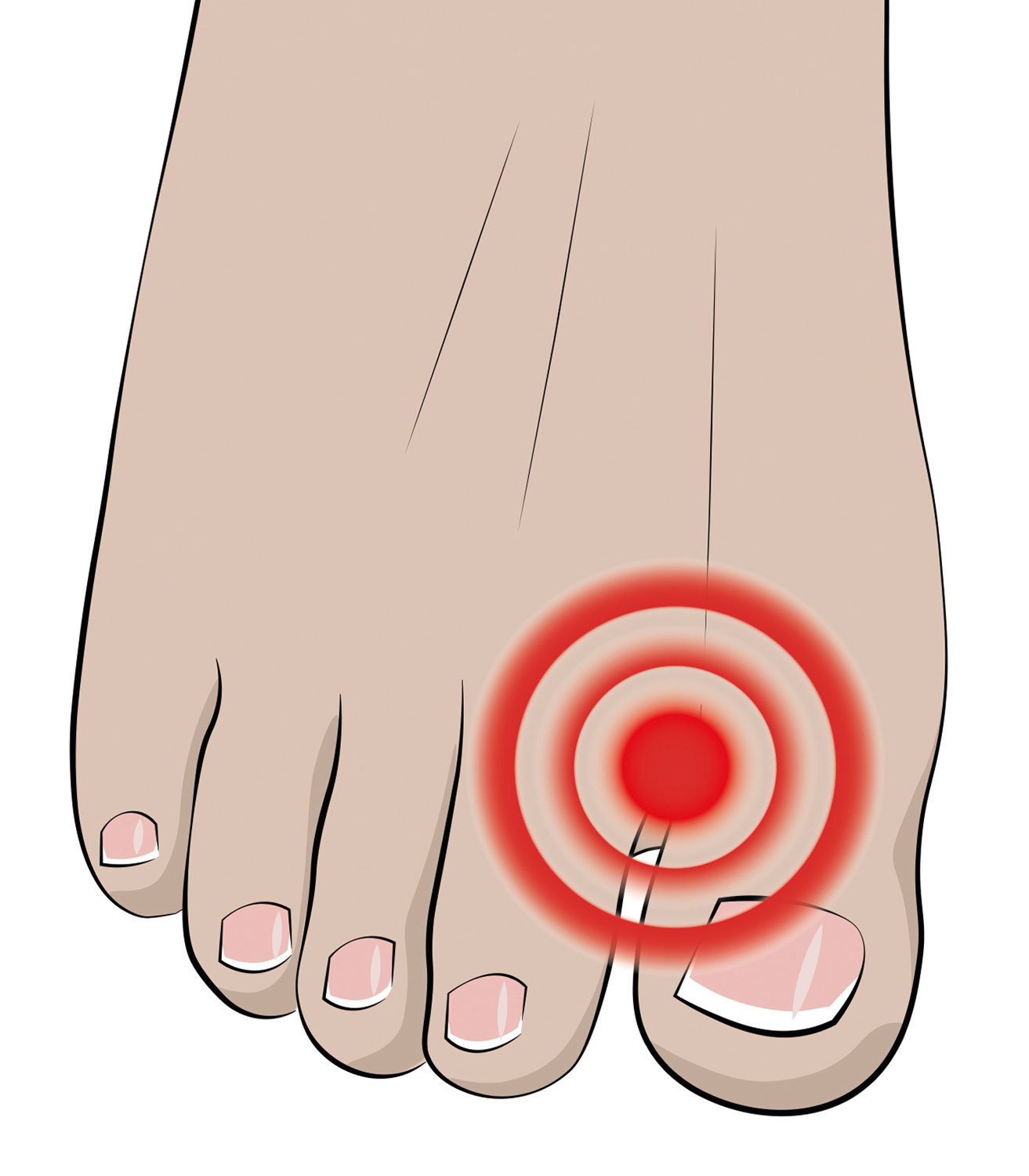 Vital Comfort Zehentrenner03