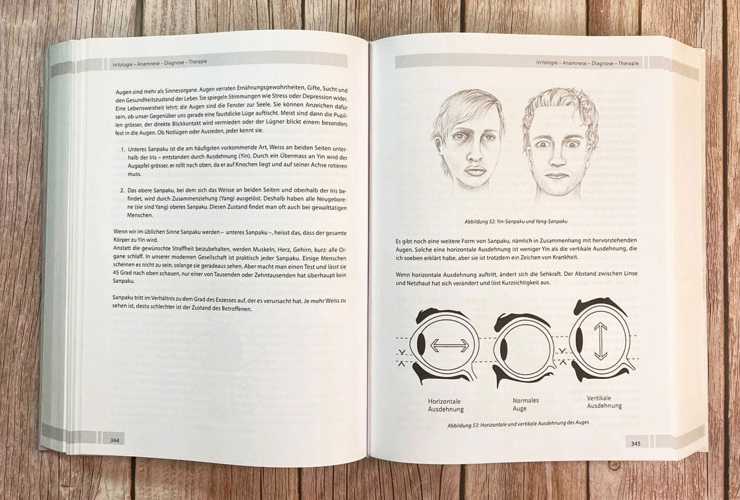 InYologie - Mngelartikel04