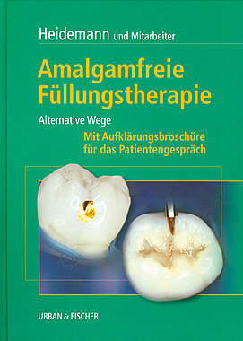 Amalgamfreie Füllungstherapie_small