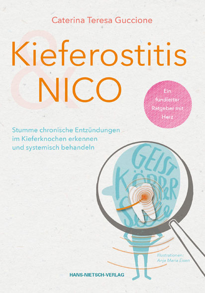 Kieferostitis & NICO - Mängelartikel